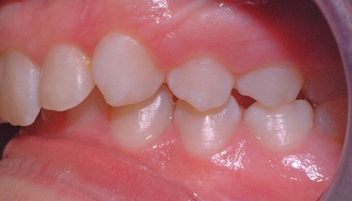 After Treatment