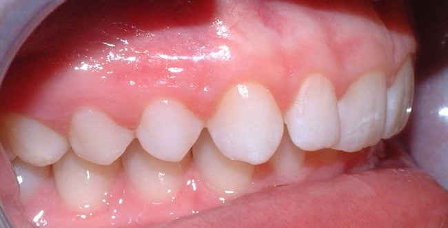 Before Treatment