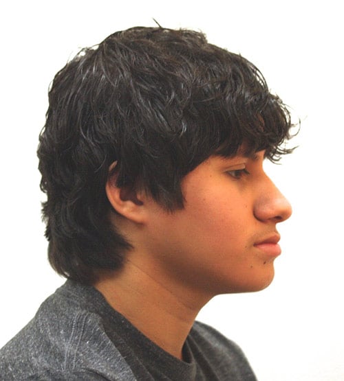 Before Treatment