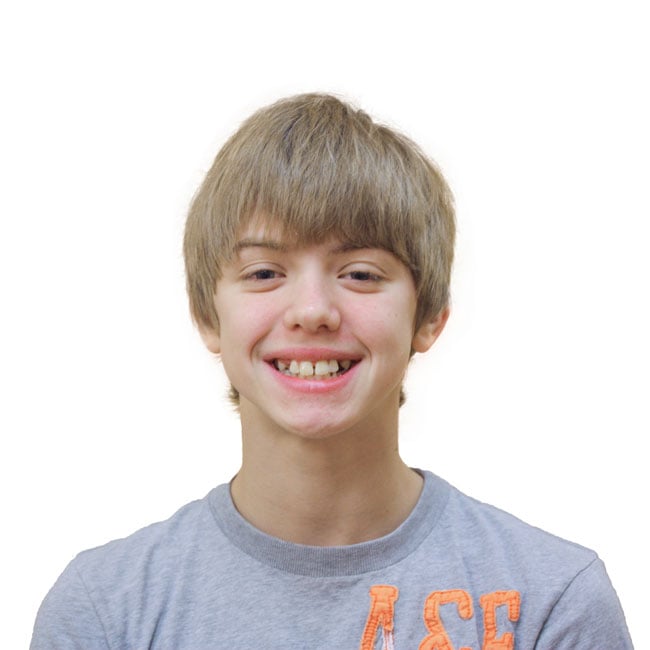 Before Treatment