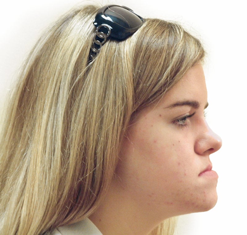 Before Treatment