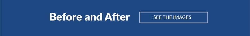 Before and after link