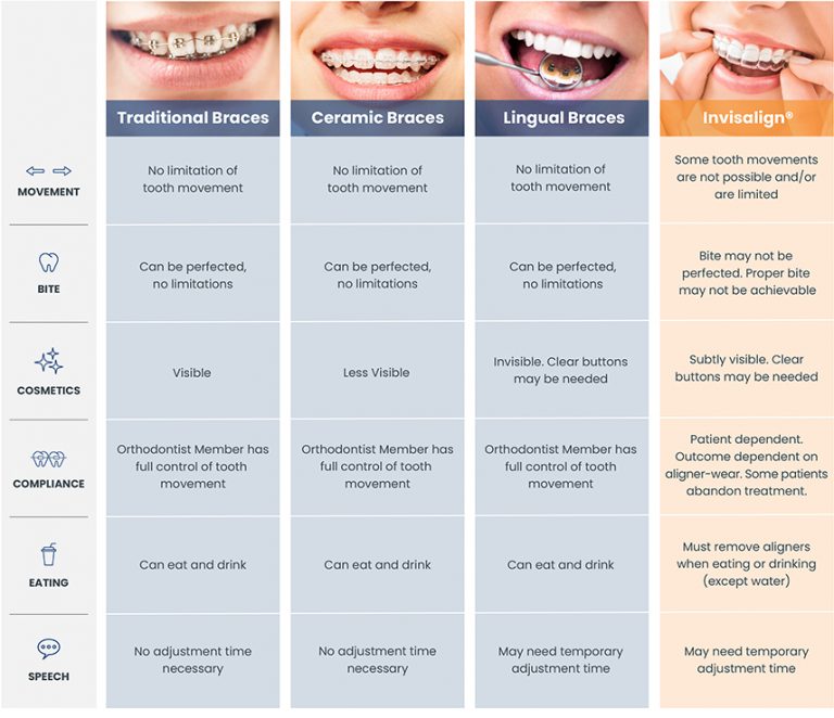 cu-nto-cuesta-invisalign-express-solo-para-los-dientes-superiores