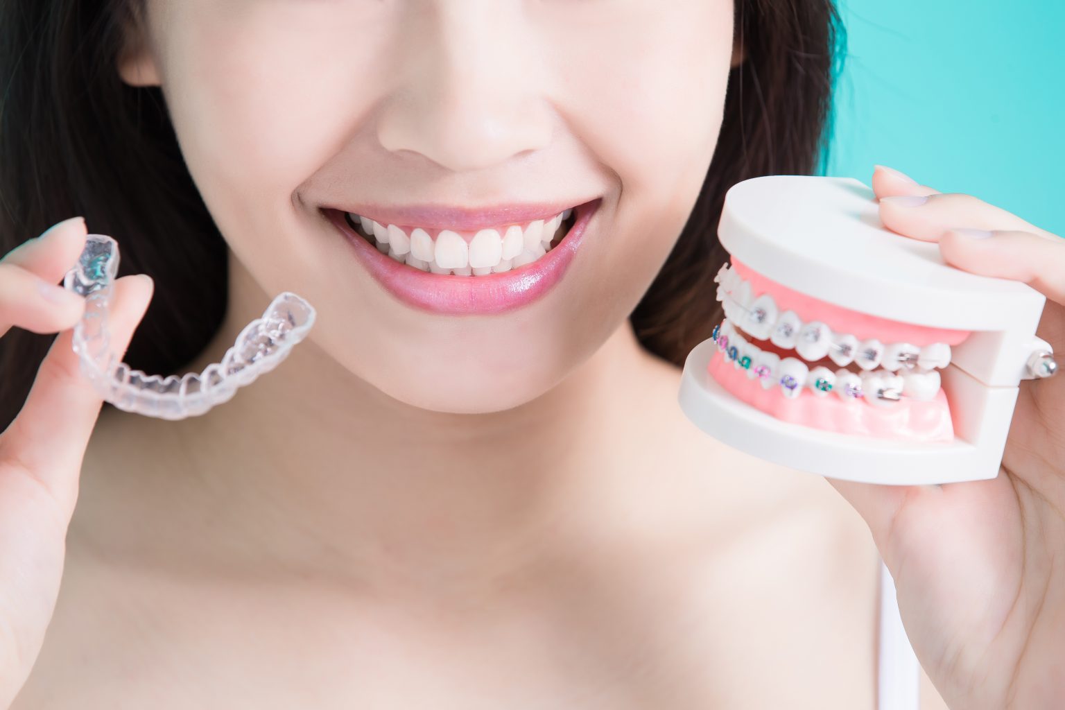 Dental Insurance & Braces Things You Should Know Tisseront Orthodontics