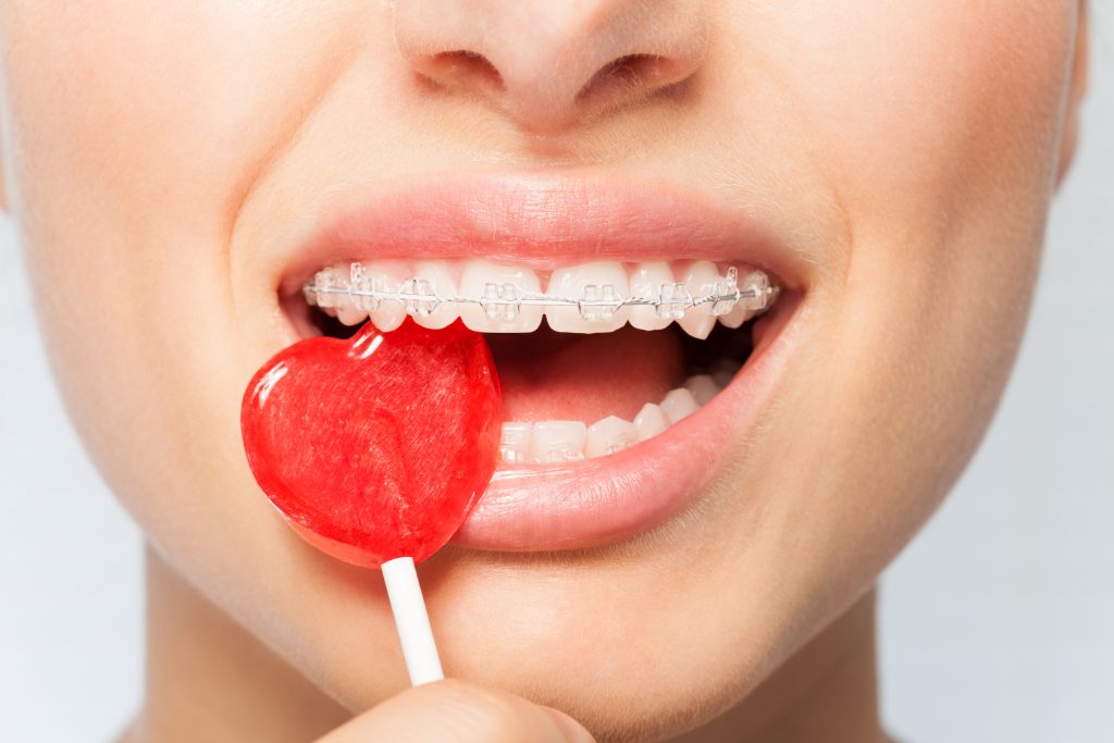 Woman with clear braces takes a half bite of a red, heart shaped lollipop