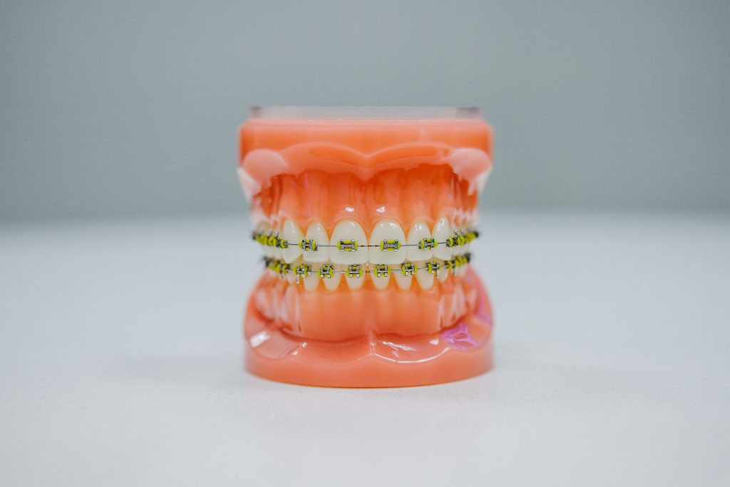 Parts of braces model