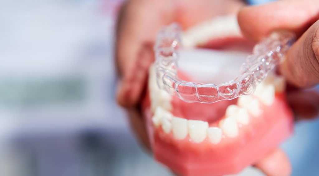 Invisalign aligners demo