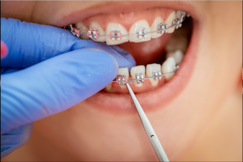 patient with braces