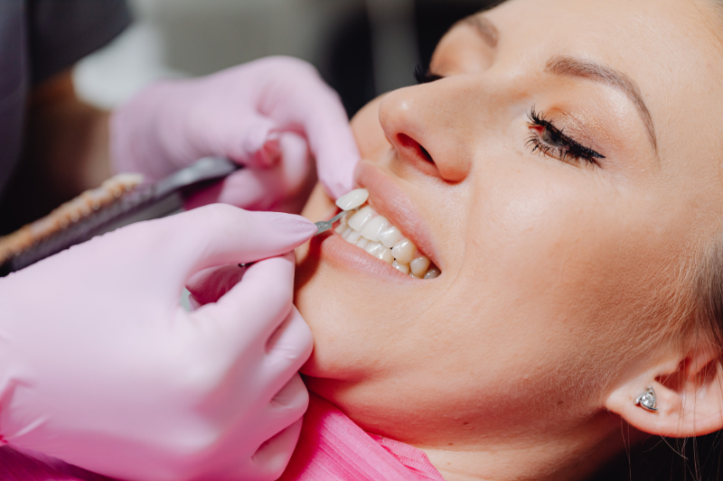 patient with veneers