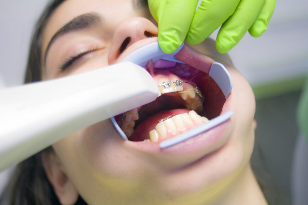 picture of girl with braces