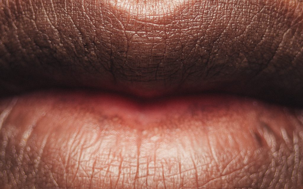 Dry mouth with braces 